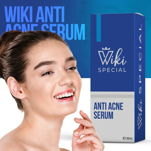 Special Anti-Acne Serum – Clears Pimples, Reduces Marks & Soothes Skin (30ml)