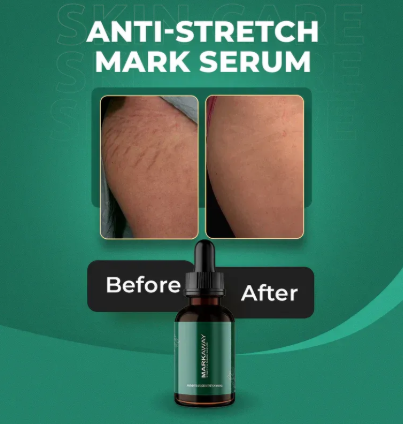 Markaway Stretch Mark Serum Helps Fade Marks, Smooth Skin & Improve Texture