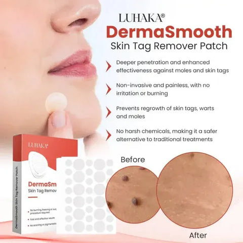DermaSmooth Skin Tag Remover Patch Fast, Safe & Painless Removal with No Scars