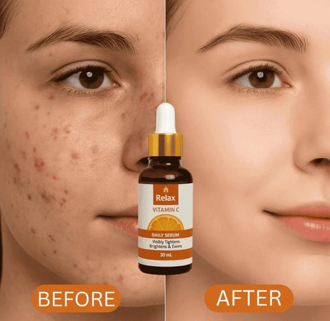 Relax Vitamin C Serum – Brightens Skin, Fades Dark Spots & Boosts Glow (30ml)