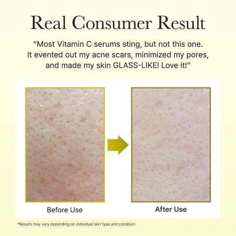 Arencia Vitamin C Booster Shot Brightens Skin, Fades Dark Spots & Boosts Radiance (30ml)